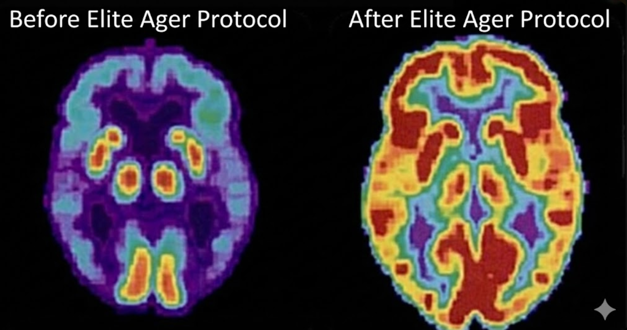 Memory and cognitive health